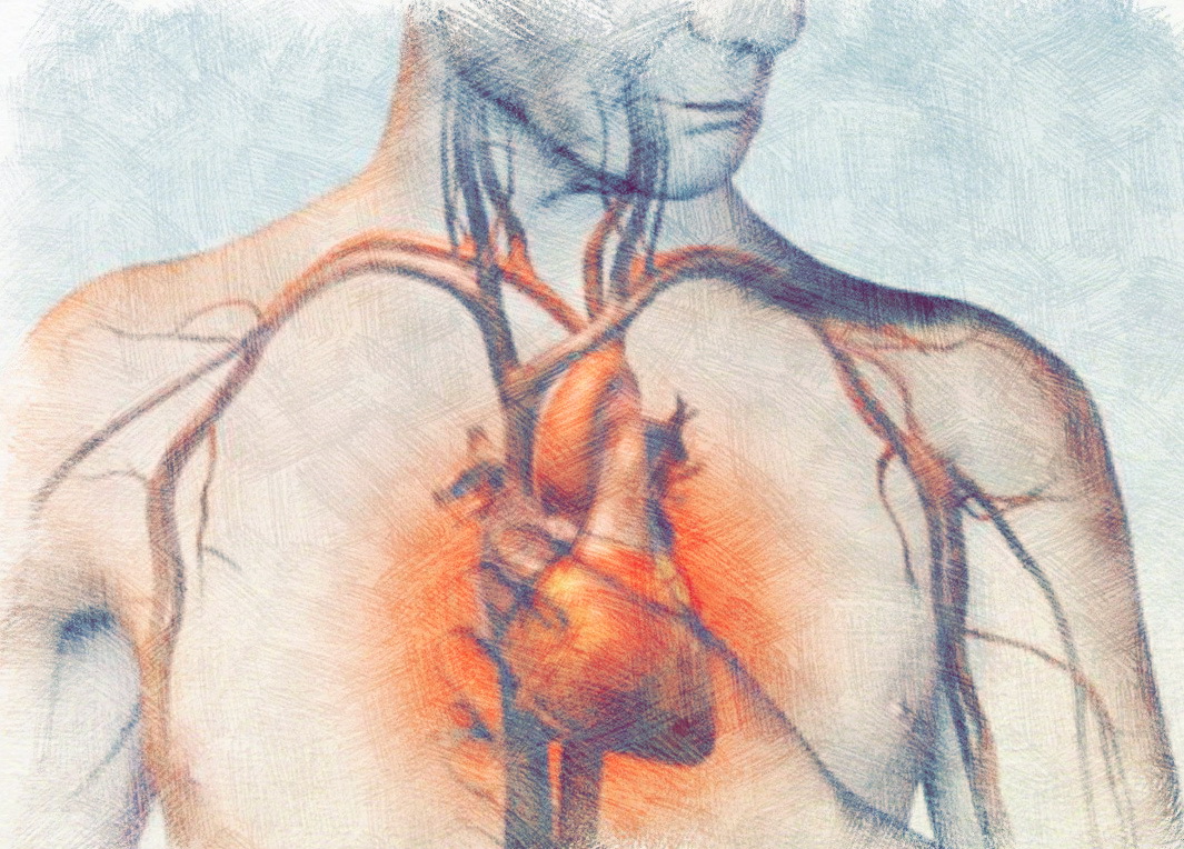 Ишемия симптомы у мужчин. Ишемическая болезнь сердца (ИБС). ИБС стенокардия инфаркт миокарда. Сердца анатомия ишемия. Болезнь коронарных артерий.
