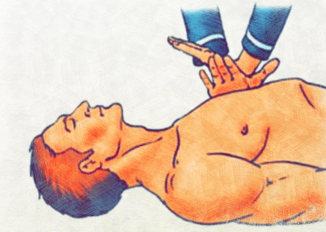 Искусственная реанимация легких и непрямой массаж
