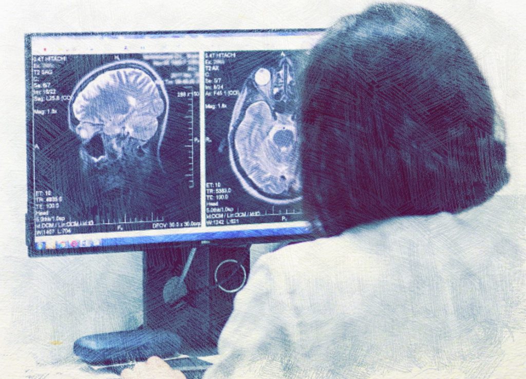 Магнитно резонансная томография головного мозга